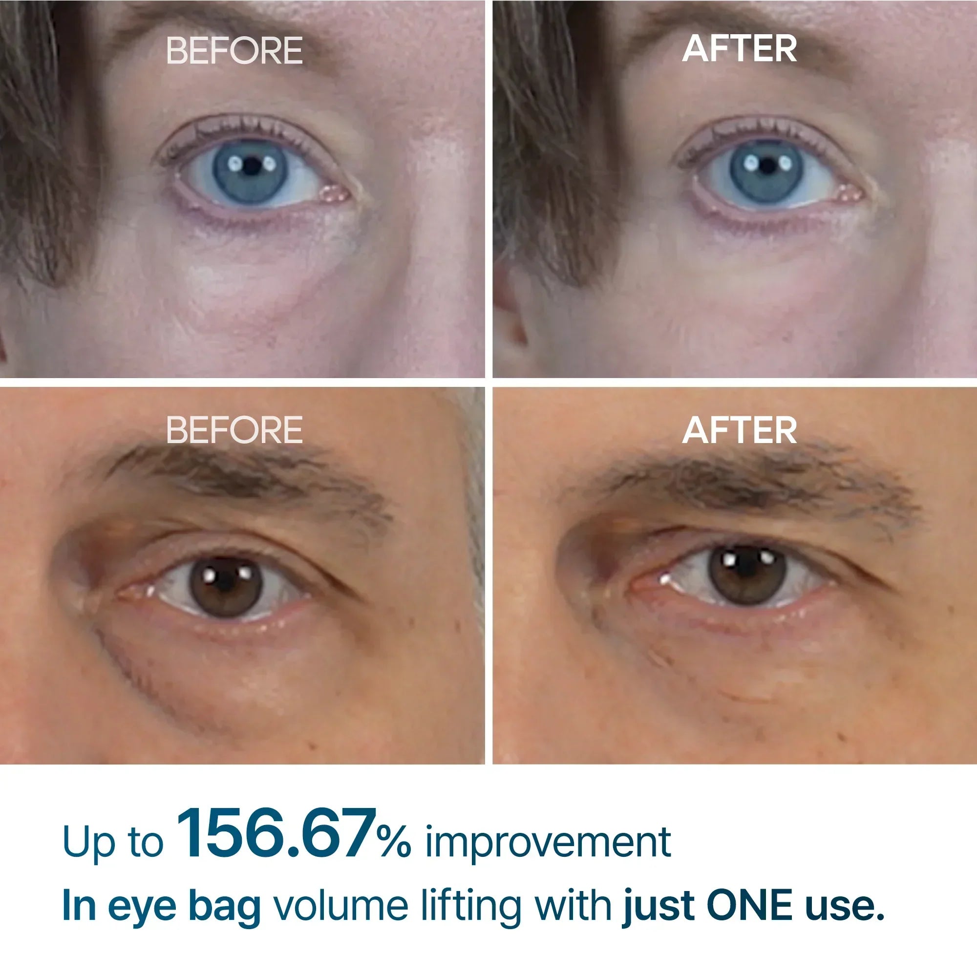 [Day&Night Care] Eyephalt Eyebag Lifting Line